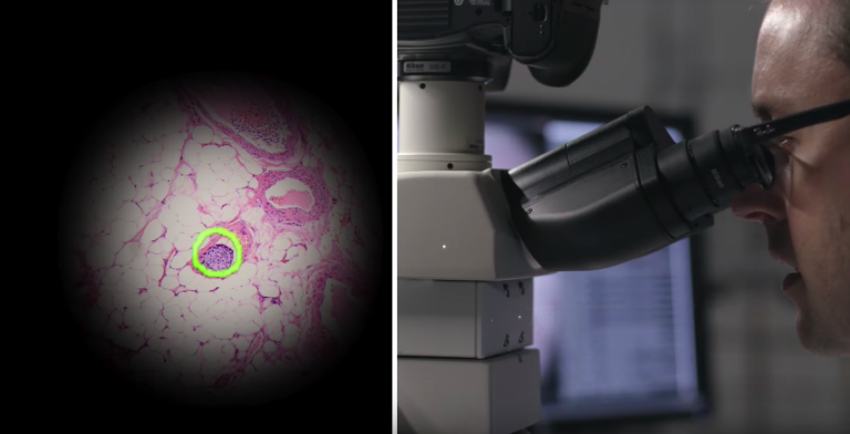 Микроскоп дополненной реальности от Google помогает искать раковые опухоли