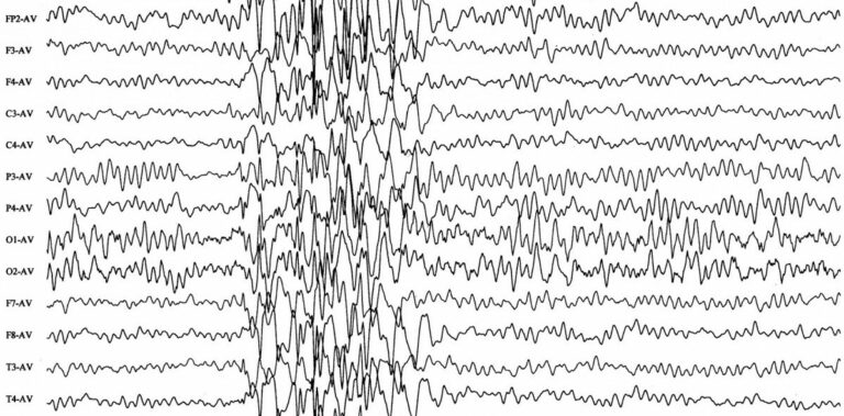 Психолог Valve: электроэнцефалографы будут в очках дополненной и виртуальной реальности