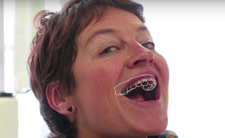 Kapanu разработала движок дополненной реальности для зубного протезирования