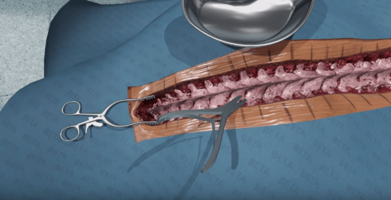 FundamentalVR привлекла $5,6 миллиона на хирургические симуляторы