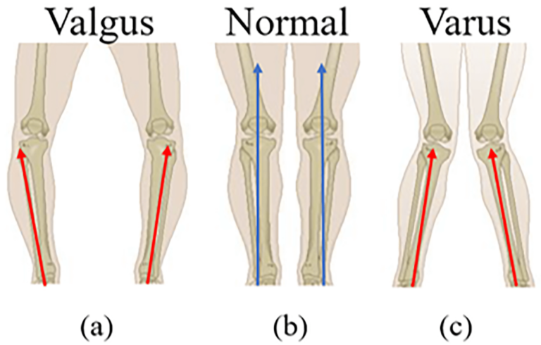 Ирландские учёные выявили полезность дополненной реальности для корректировки отклонений походки