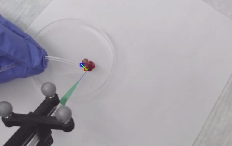 Дополненную реальность и масс-спектрометрию объединили для хирургических операций