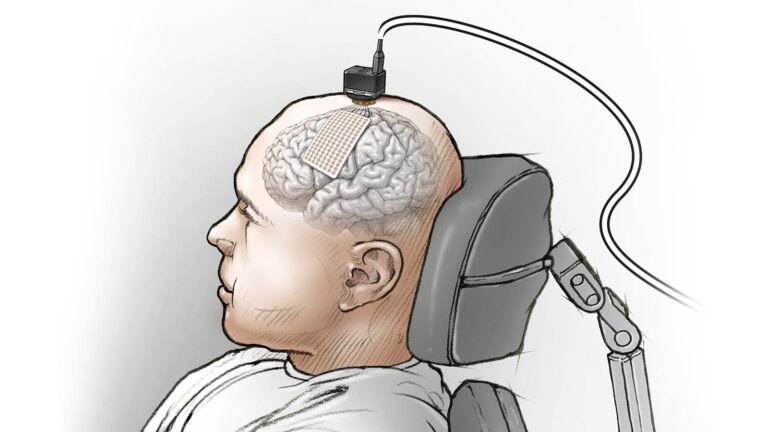 Facebook отчиталась об исследовании имплантируемых нейрокомпьютерных интерфейсов