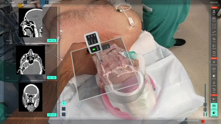Разработчик иммерсивной хирургической визуализации Medivis привлёк $20 млн