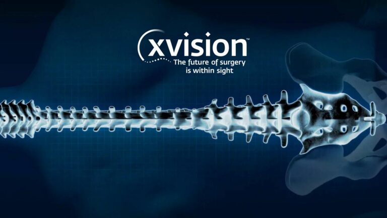 Augmedics привлекла впечатляющий для своей ниши раунд на $82,5 млн