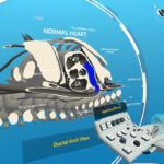 В App Lab появилось приложение за $240. Это симулятор УЗИ