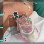 Разработчик иммерсивной хирургической визуализации Medivis привлёк $20 млн