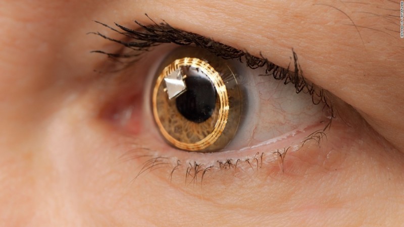 150304164308-smart-contact-lens---sensimed-super-169