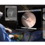 Stryker провела первую артроскопию с помощью приложения для Vision Pro