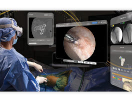 Stryker провела первую артроскопию с помощью приложения для Vision Pro