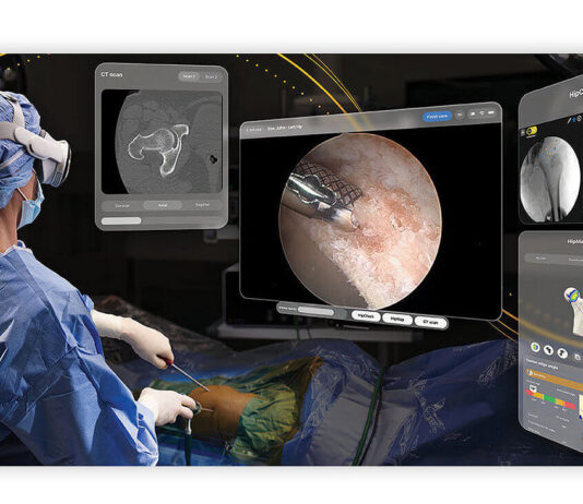 Stryker провела первую артроскопию с помощью приложения для Vision Pro